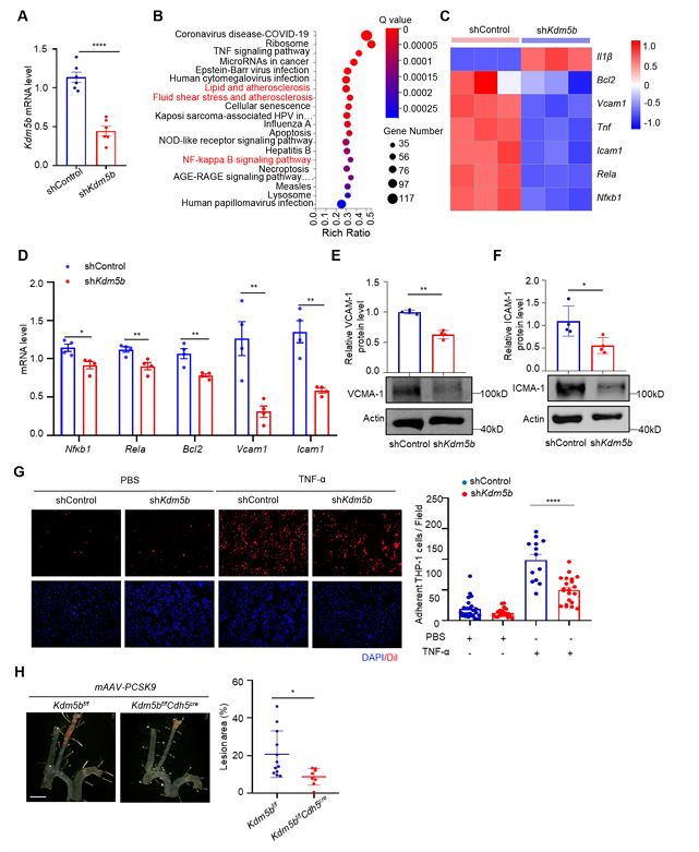 Piezo1 調(diào)控的內(nèi)皮 KDM5B 參與紊亂血流誘導(dǎo)的動(dòng)脈粥樣硬化斑塊形成